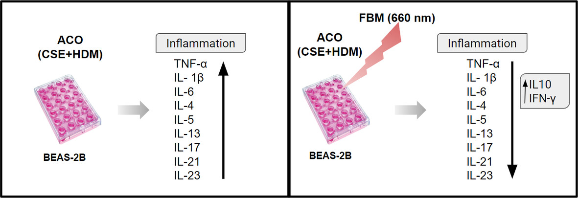 Effect of photobiomodulation in an experimental in vitro model of asthma-Copd overlap