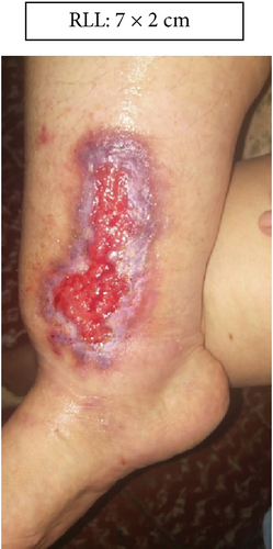 Details are in the caption following the image Details are in the caption following the image