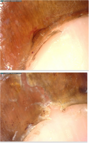 Details are in the caption following the image Details are in the caption following the image