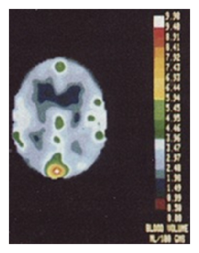 Details are in the caption following the image