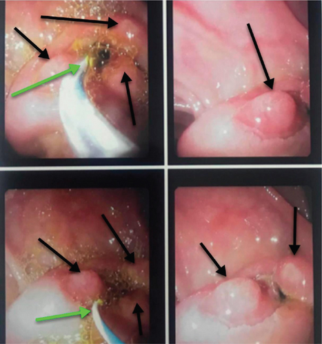Details are in the caption following the image Details are in the caption following the image