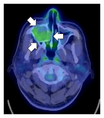 Details are in the caption following the image