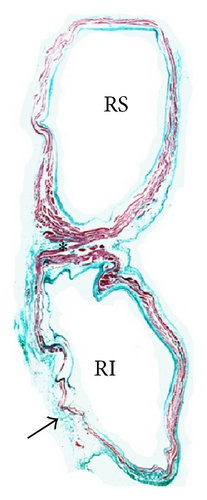 Details are in the caption following the image