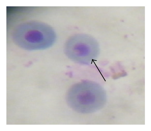 Details are in the caption following the image