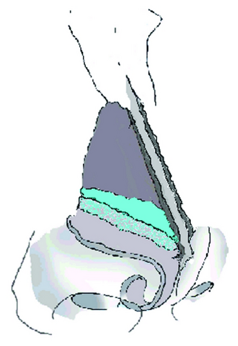Details are in the caption following the image