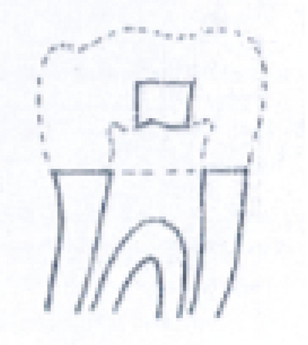 Details are in the caption following the image