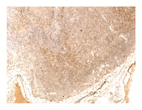 Details are in the caption following the image