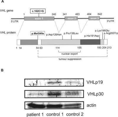 Novel Homozygous Mutation of the Internal Translation Initiation Start Site of VHL is Exclusively Associated with Erythrocytosis: Indications for Distinct Functional Roles of von Hippel-Lindau Tumor Suppressor Isoforms