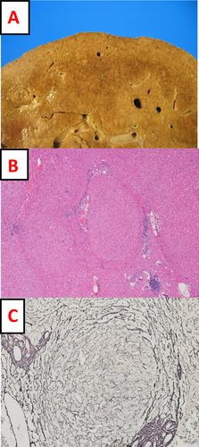 Details are in the caption following the image Details are in the caption following the image