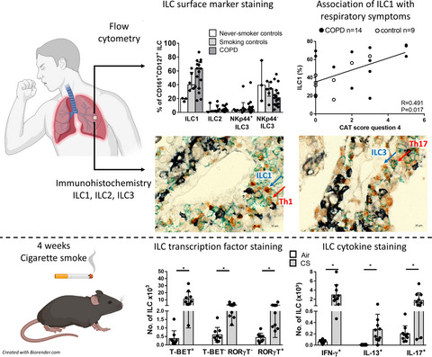 Quantification and role of innate lymphoid cell subsets in Chronic Obstructive Pulmonary Disease