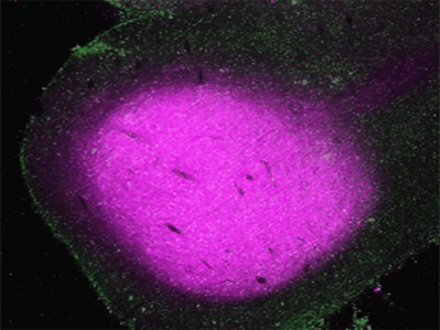 Regional and age-related differences in GAD67 expression of parvalbumin- and calbindin-expressing neurons in the rhesus macaque auditory midbrain and brainstem