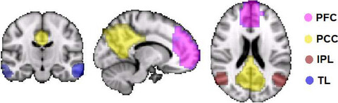 Objective and subjective measures of prior sleep–wake behavior predict functional connectivity in the default mode network during NREM sleep