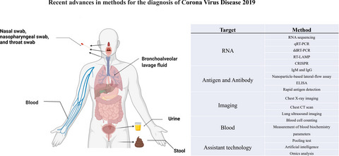 Recent advances in methods for the diagnosis of Corona Virus Disease 2019