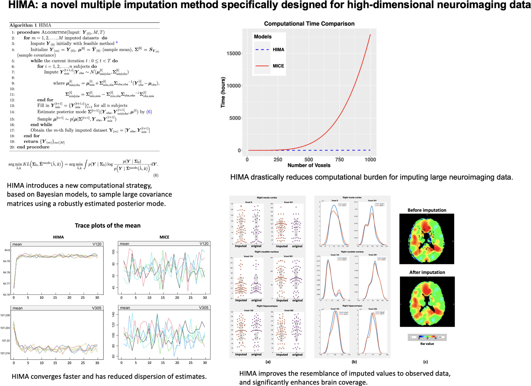 A New Multiple Imputation Method for High-Dimensional Neuroimaging Data