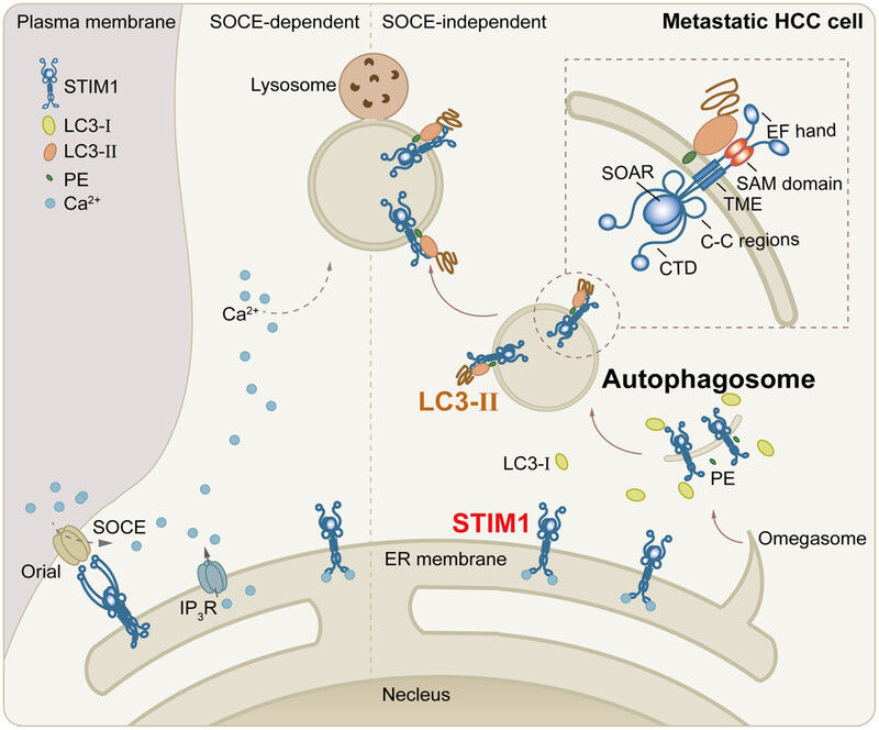 Stromal interaction molecule 1/microtubule-associated protein 1A/1B-light chain 3B complex induces metastasis of hepatocellular carcinoma by promoting autophagy