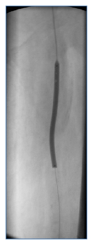 Details are in the caption following the image