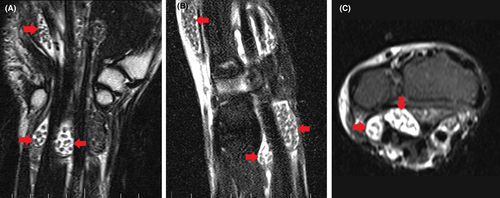 Details are in the caption following the image Details are in the caption following the image