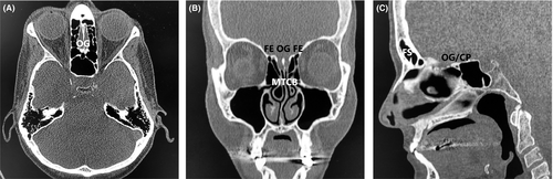 Details are in the caption following the image Details are in the caption following the image