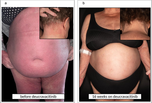 Details are in the caption following the image Details are in the caption following the image