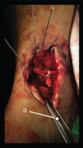 Details are in the caption following the image Details are in the caption following the image