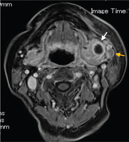 Details are in the caption following the image