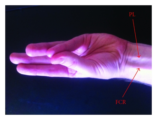 Details are in the caption following the image Details are in the caption following the image