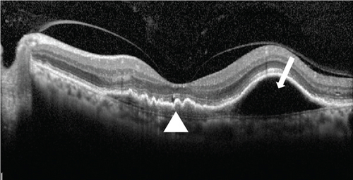 Details are in the caption following the image Details are in the caption following the image