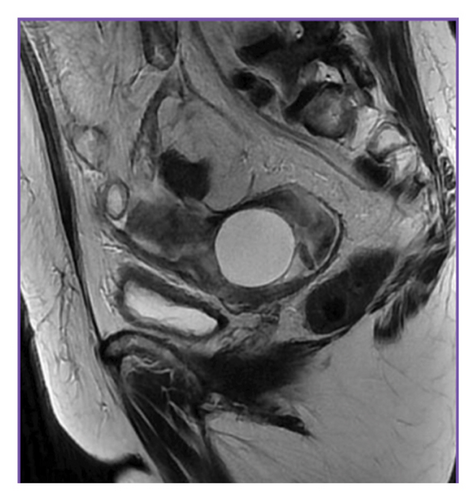 Details are in the caption following the image
