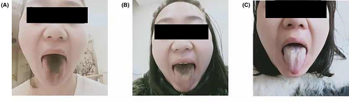 Details are in the caption following the image Details are in the caption following the image