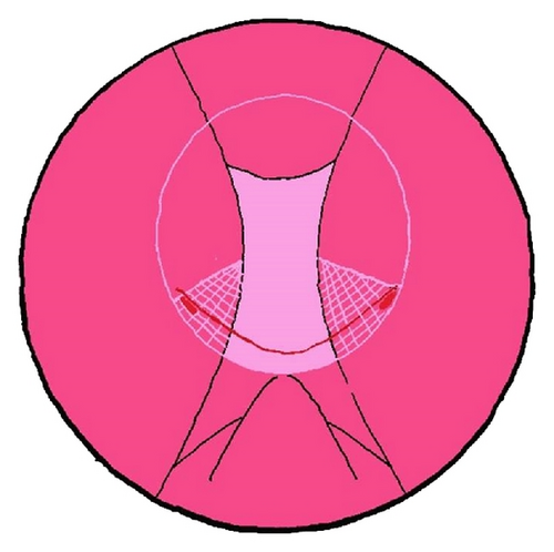Details are in the caption following the image