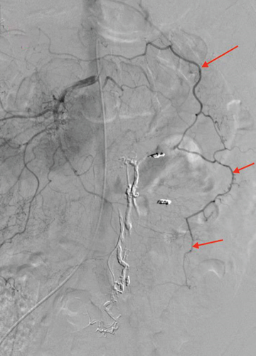 Details are in the caption following the image Details are in the caption following the image