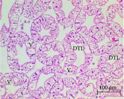Details are in the caption following the image