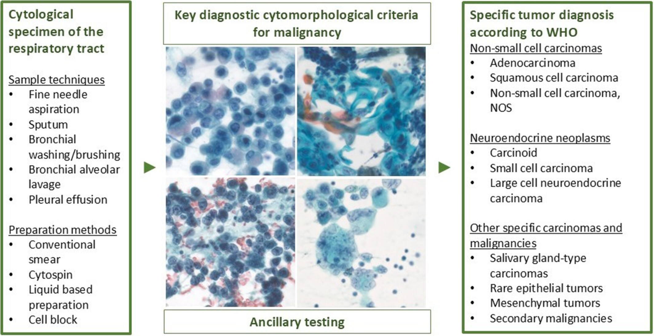 Diagnosing Malignant Epithelial Neoplasms of the Lung in Cytological Specimens: Cytomorphology, Ancillary Studies and Management