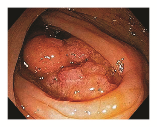 Details are in the caption following the image Details are in the caption following the image