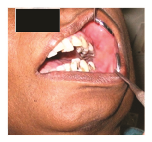 Details are in the caption following the image