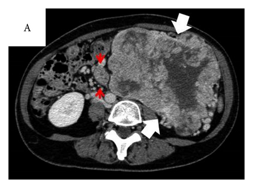 Details are in the caption following the image Details are in the caption following the image