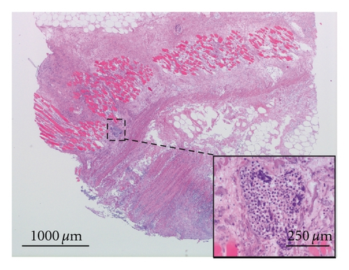 Details are in the caption following the image