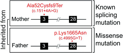 Analysis of novel missense ATR mutations reveals new splicing defects underlying Seckel syndrome