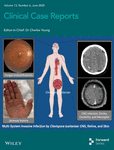 Clinical Case Reports