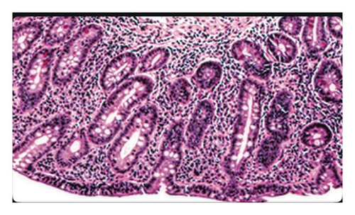 Details are in the caption following the image