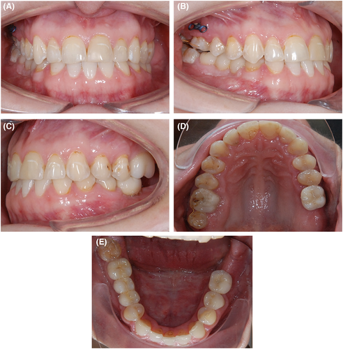 Details are in the caption following the image Details are in the caption following the image