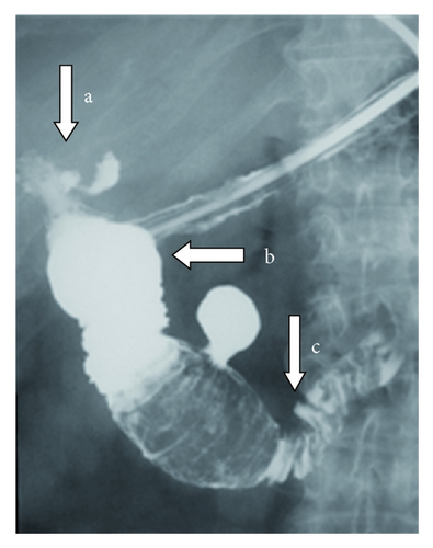 Details are in the caption following the image