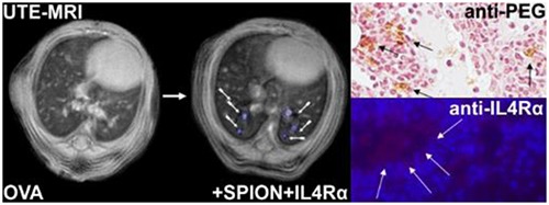 Specific targeting and noninvasive magnetic resonance imaging of an asthma biomarker in the lung using polyethylene glycol functionalized magnetic nanocarriers