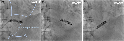 Details are in the caption following the image Details are in the caption following the image