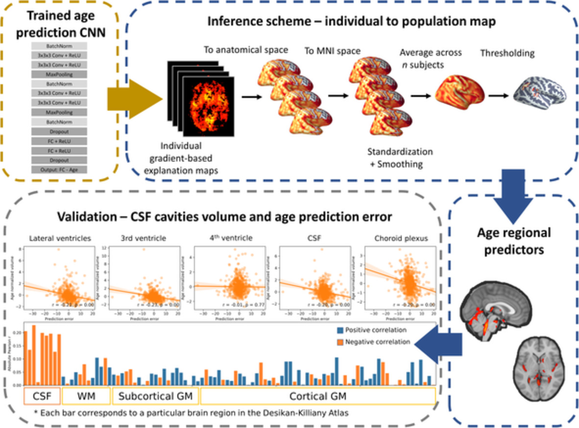 From a deep learning model back to the brain—Identifying regional predictors and their relation to aging