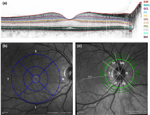 Relation of retinal and hippocampal thickness in patients with amnestic mild cognitive impairment and healthy controls