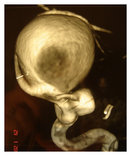 Details are in the caption following the image