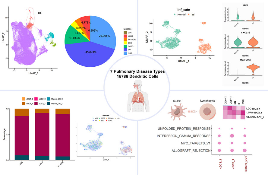 Inflammatory-associated myeloid dendritic cells reveals associations between chronic lung diseases and lung cancer