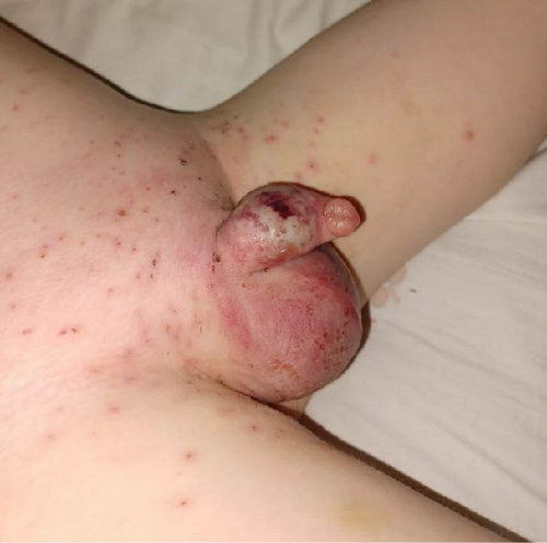 Details are in the caption following the image Details are in the caption following the image