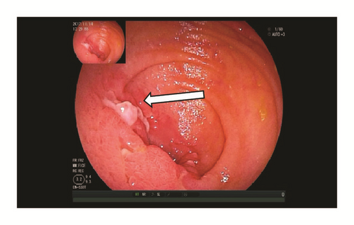 Details are in the caption following the image Details are in the caption following the image